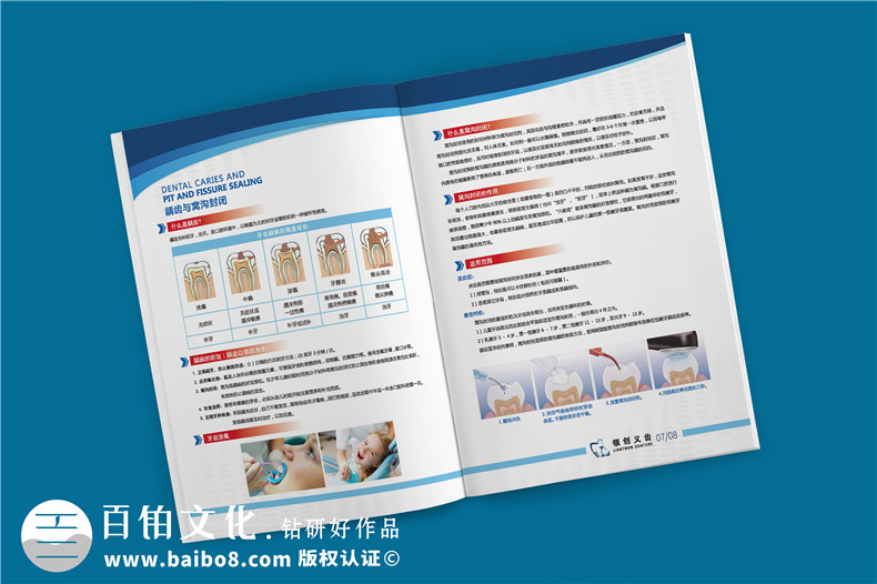 義齒加工宣傳冊(cè)設(shè)計(jì)的主要內(nèi)容-義齒制作公司的產(chǎn)品宣傳方式第4張-宣傳畫(huà)冊(cè),紀(jì)念冊(cè)設(shè)計(jì)制作-價(jià)格費(fèi)用,文案模板,印刷裝訂,尺寸大小